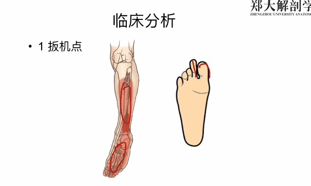 1653857256 每日一肌全身肌肉疼痛讲解