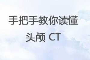 手把手教你读懂头颅 CT