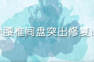 14天腰椎间盘突出修复计划