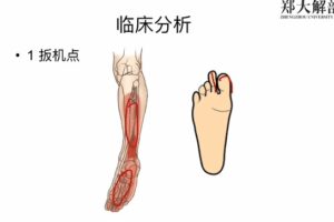 每日一肌全身肌肉疼痛讲解