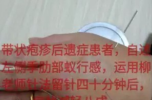 柳华山手针教学-民间中医技法研究会柳华山手针讲课音频近100集