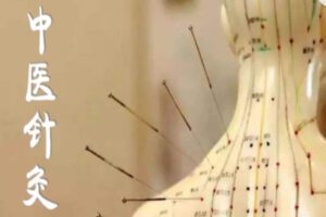 【99[红包]·S2100康复理疗（中医针灸）】