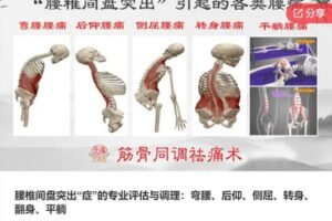 【60[红包]·S6777腰椎间盘突出“症”的专业评估与调理：弯腰、后仰、侧屈、转身、翻身、平躺】