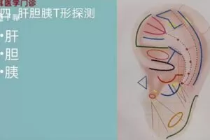 张福旺精讲耳穴诊断班