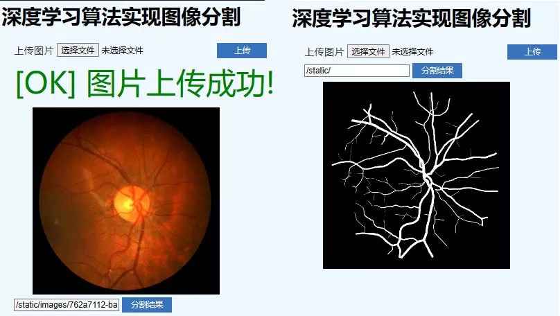 医学影像与图像分割：深度学习项目课